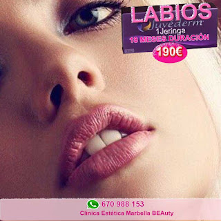 AUMENTO de LABIOS en Marbella. Ácido Hialurónico, JUVEDERM en Clinica Estética Marbella.