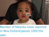 https://sciencythoughts.blogspot.com/2019/09/number-of-measles-cases-reported-in-new.html