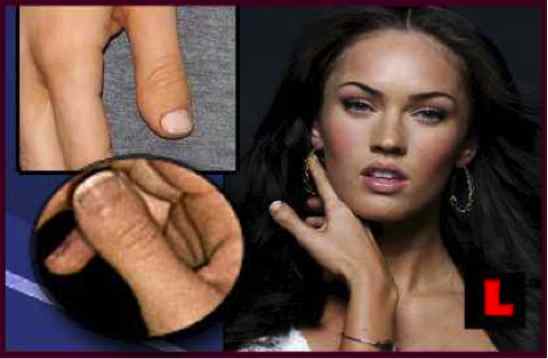 megan fox thumbs up. megan fox thumb surgery. megan