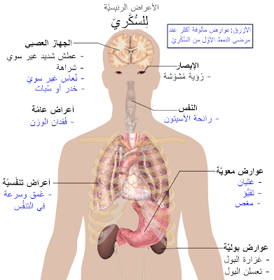 أعراض السكري