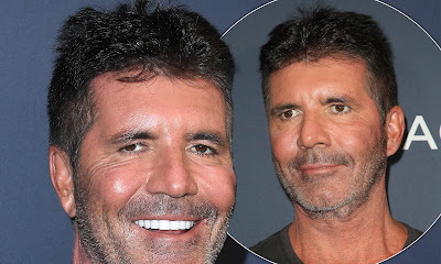 Simon Cowell's years of Botox and fillers left him with permanently 'sad face'