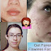 Get Rid From Acnes, Scars, Marks Permanently