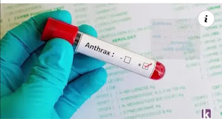 JUST IN :Boiling your meat well does not kill anthrax, expert warns Nigerians