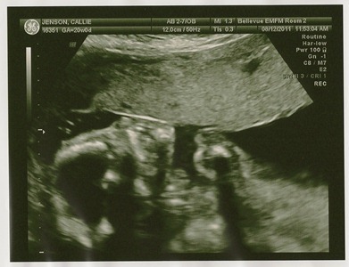 SCAN0007