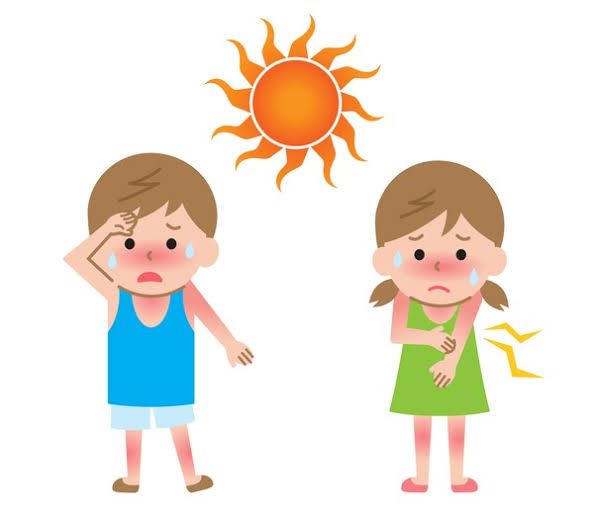 Causes of Sunburn due to Heat