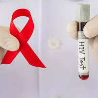 Paquete de Pruebas de Diagnostico VIH