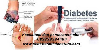 obat diabetes militus,obat herbal diabetes,obat diabetes herbal,cara mengobati diabetes secara herbal,pengobatan diabetes secara herbal,pengobatan diabetes tanpa resep dokter