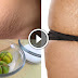 This Simple Lemon Trick Will Help You To Remove The Stretch Marks Of Abdomen And Thighs