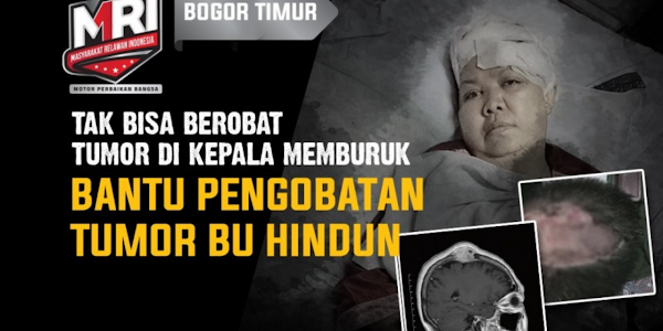 Abses Ringan Berujung Pada Tumor di Kepala