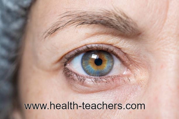 Eyelids turning inward - Health-Teachers