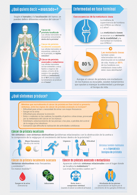 infografia cancer de prostata