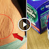 How To Remove Stretch Marks By Using Vicks Vaporub