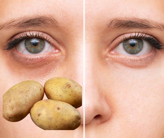 atténuer les cernes avec la pomme de terre