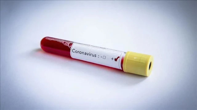 المهدية : تسجيل 31 إصابات جديدة بفيروس كورونا