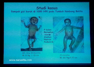 Resep MPASI Ini Bikin Sukses Anak di Masa Depan