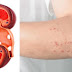If Your Kidney Is In Danger, The Body Will Give You These 8 Signs!