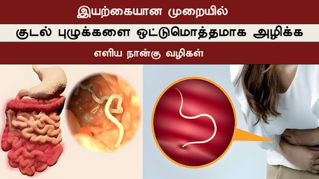 remove intestinal worms