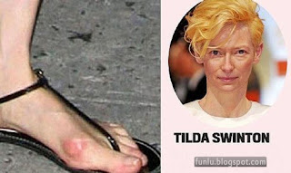 +Ugly feet celebrities+(2) Ugly Feet Of The Celebrities