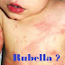 Ciri - Ciri Virus Rubella Menyerang Anak