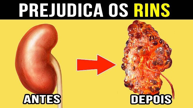 Você sabe quais são os hábitos alimentares que podem afetar a saúde dos rins?