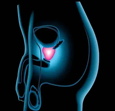 كيفية الوقاية من سرطان البروستاتا؟