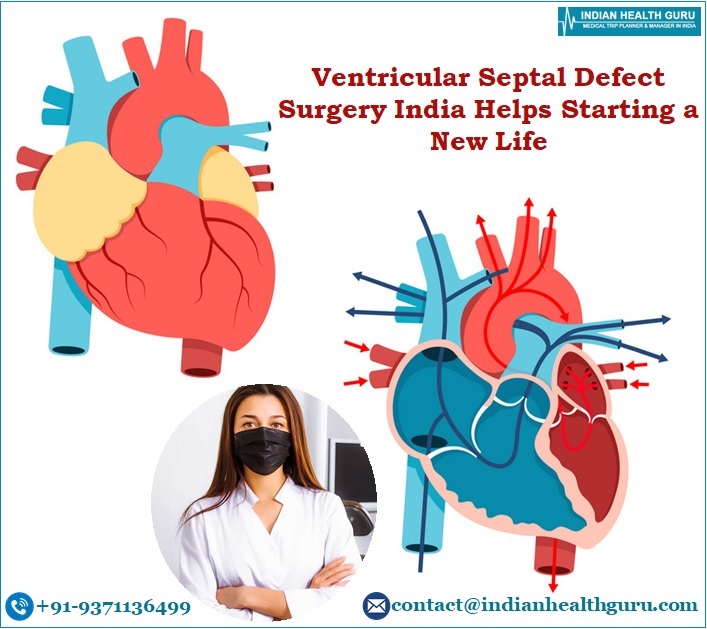 Ventricular Septal Defect Surgery India