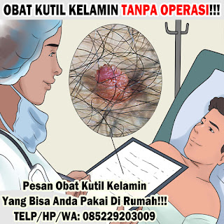 Obat Kutil Kelamin