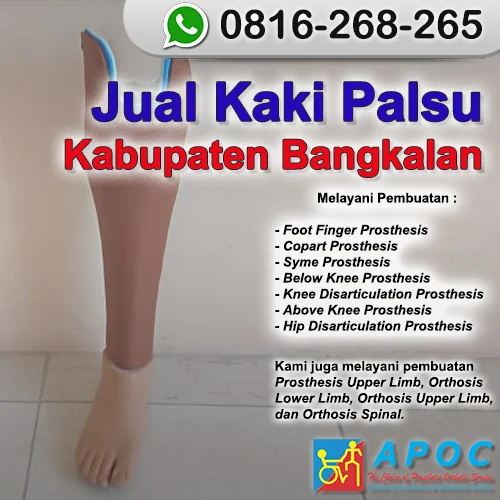 Jual Kaki Palsu Kabupaten Bangkalan >> WA 0816-268-265, Kaki Palsu Asli