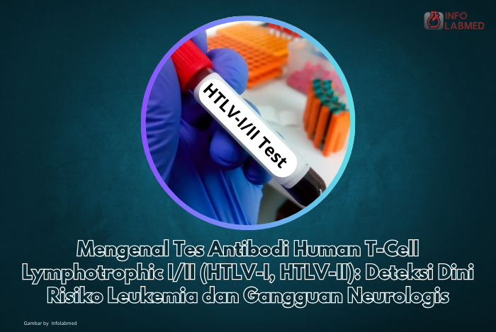 Mengenal Tes Antibodi Human T-Cell Lymphotrophic III (HTLV-I, HTLV-II) Deteksi Dini Risiko Leukemia dan Gangguan Neurologis