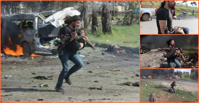 Sesaat Lupakan Kamera Dan Profesi Demi Kemanusiaan, Fotografer Ini Pilih Tolong Bocah Korban Bom...