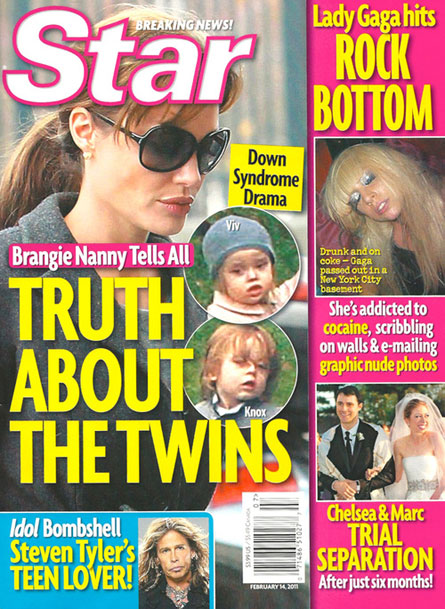 angelina jolie and brad pitt twins down syndrome. might have Down syndrome.