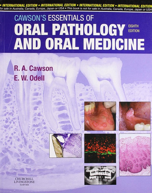  Cawson's Essentials of Oral Pathology and Oral Medicine 8th Edition