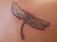 ... Difference: Update: New Tattoo Removal System at Cosmetic Laser MD