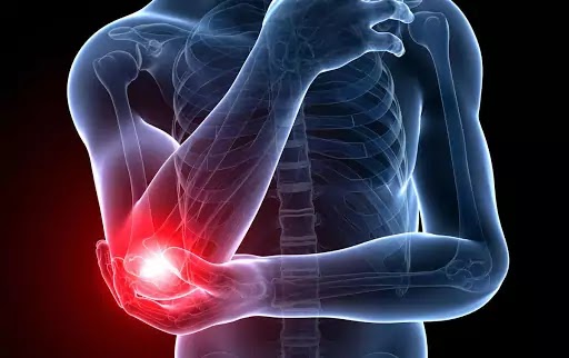 The End of Elbow Pain | Nick Rana