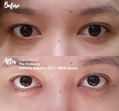 Before after The Ordinary Caffeine Solution 5% EGCG