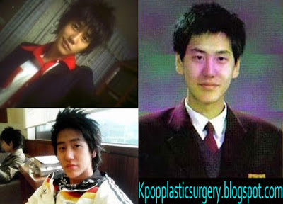 Kyuhyun Plastic Surgery Before