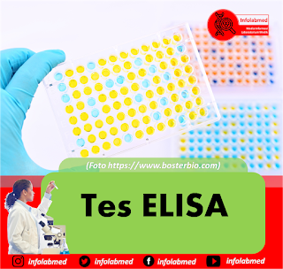 Tes ELISA,test elisa,tes elisa adalah,tes elisa hiv pdf,tes elisa hiv,tes elisa untuk hiv,test elisa vih,test elisa hiv,test elisa principe,test elisa pret,test elisa pdf,test elisa cena,test elisa synevo,test elisa intolleranze alimentari,test elisa lyme,test elisa protocol,test elisa francais,test elisa borelioza,test elisa warszawa,test elisa gratis,test elisa glyphosate,tes elisa hiv adalah,tes elisa untuk hiv aids,alat tes elisa,biaya tes elisa di prodia,biaya tes elisa,cara tes elisa,cara tes elisa hiv