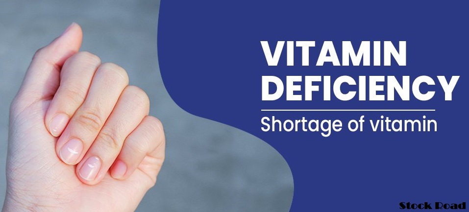 विटामिन की कमी का प्रभाव: शरीर में न होने दें विटामिन की कमी, वरना रह जाएंगे महरूम (Effect of vitamin deficiency: Do not allow vitamin deficiency in the body, otherwise you will remain bereft)