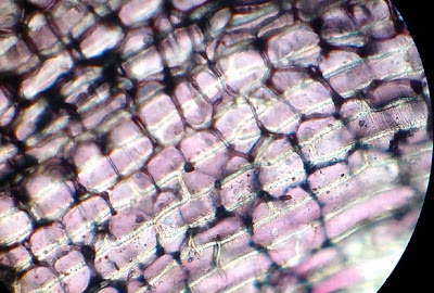 onion cells