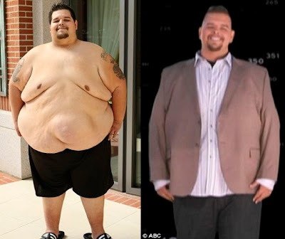 James Garrison Loses a Record-Breaking 313lbs on Extreme Makeover Seen On coolpicturesgallery.blogspot.com