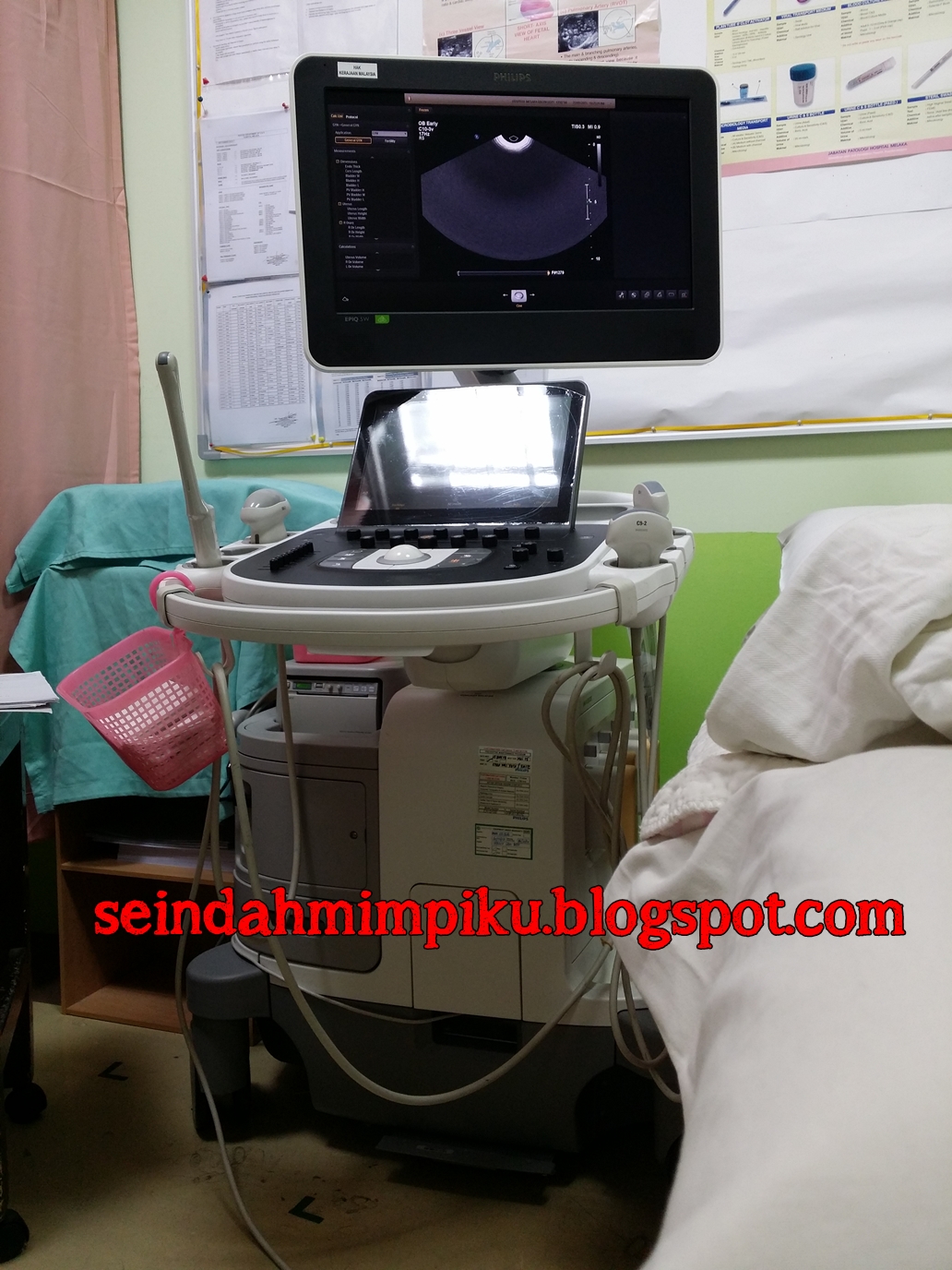 Seindah Mimpiku: Pap Smear, Pipelle Sampling Ke-3 & HSA 