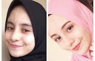 Testimoni Jujur Tabita Skin Care Asli