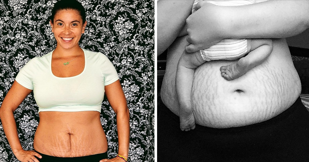 25 Women Shared Their Powerful Postpartum Pictures