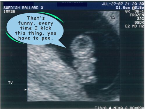 Lawak lawak pilihan cam haram: Ultrasound Funny