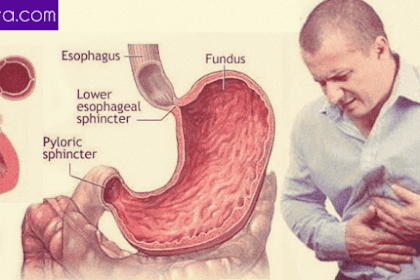 The causes and Tackle Rising stomach acid