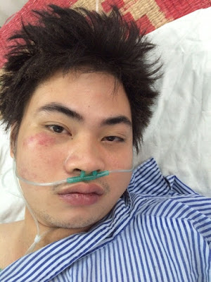 Nguyễn Thanh Phong bị thương, được điều trị tại bệnh viện