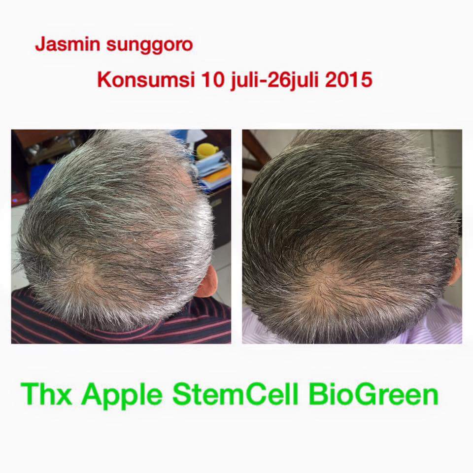 Apple Stem Cell Plus Mengatasi Rambut Rontok BioGreen Science