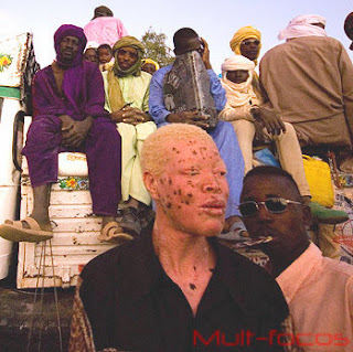 Homem Albino de niger