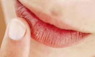 This method makes chapped lips healthy back