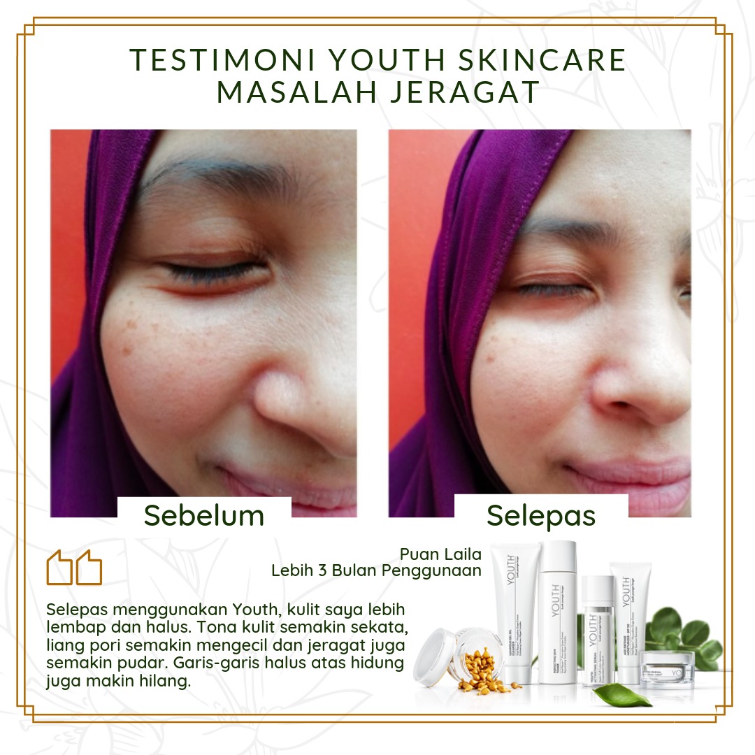 Testimoni YOUTH Skincare Untuk Masalah Jeragat